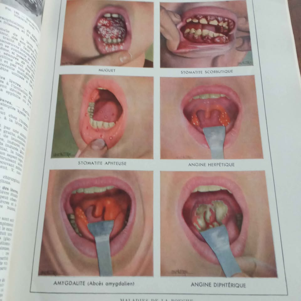 FRENCH LAROUSSE MEDICAL ILLUSTRATION BOOK 1952