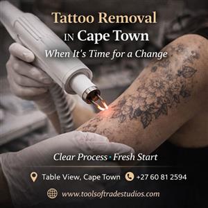 Tattoo Removal in Cape Town – When It’s Time for a Change