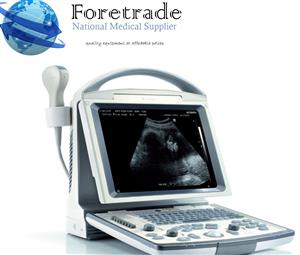 Fairly Used DP10 Ultrasound Machine for Sale R33499
