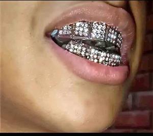 Grilz full set of  silver rhinestones