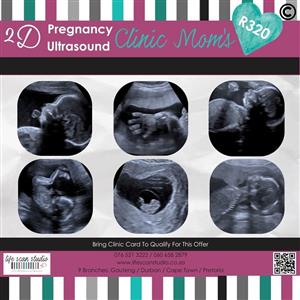 PREGNANCY ULTRASOUNDS 