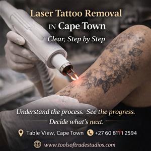Laser Tattoo Removal in Cape Town – Clear, Step by Step